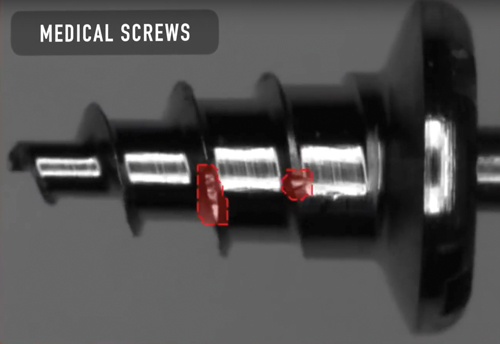 Defect detection in a rotating medical screw. It is far simpler to train a system that understands how to spot what is wrong than one to identify all possibilities.