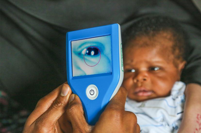 Neocam can be used to detect congenital cataracts in newborns