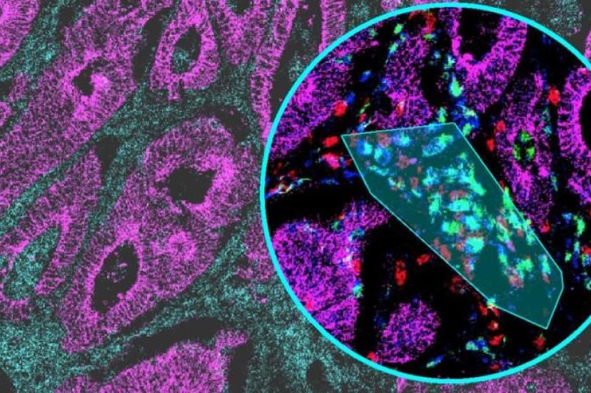 Immunofluorescence multiplex image of human colon tissue