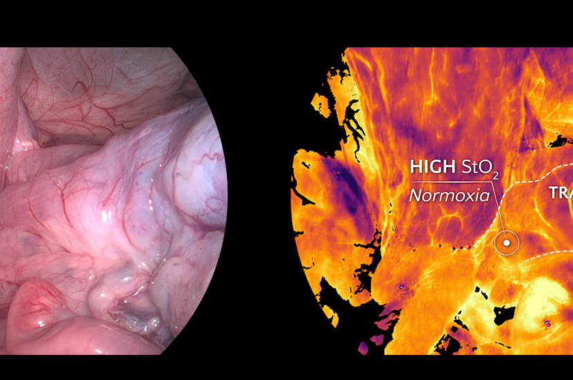 Standard vs hyperspectral image