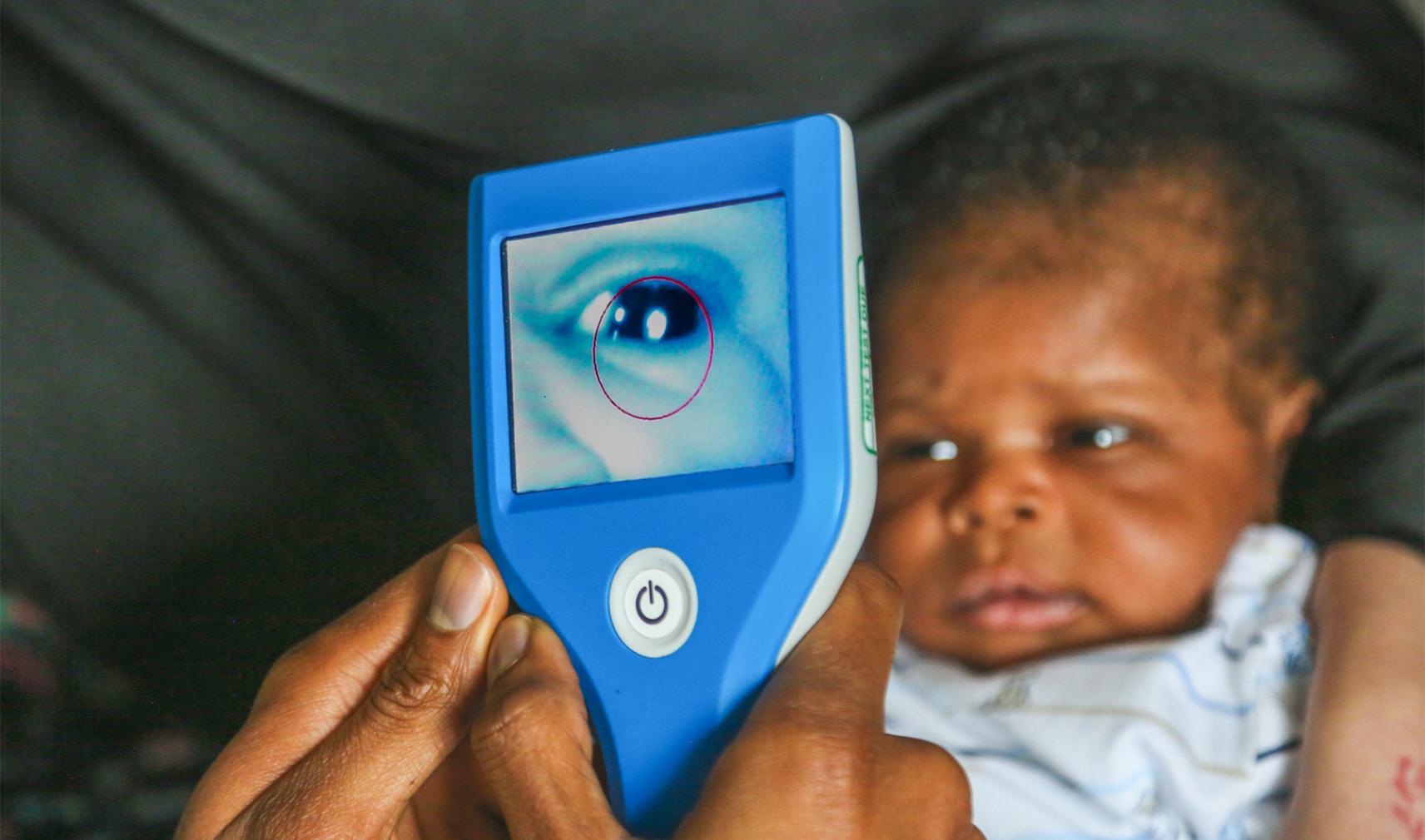 Neocam can be used to detect congenital cataracts in newborns