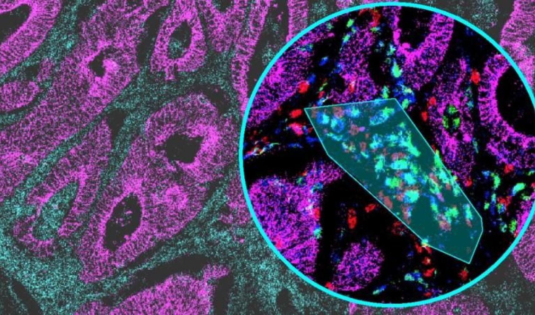 Immunofluorescence multiplex image of human colon tissue