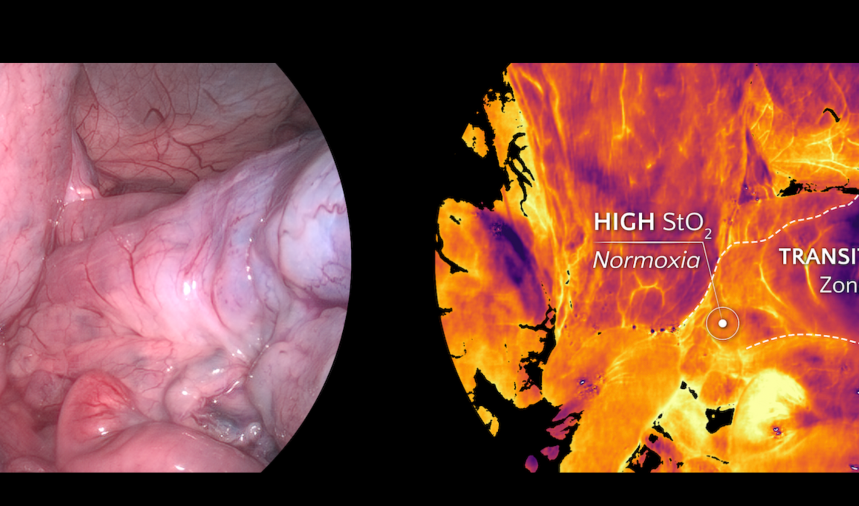 Standard vs hyperspectral image