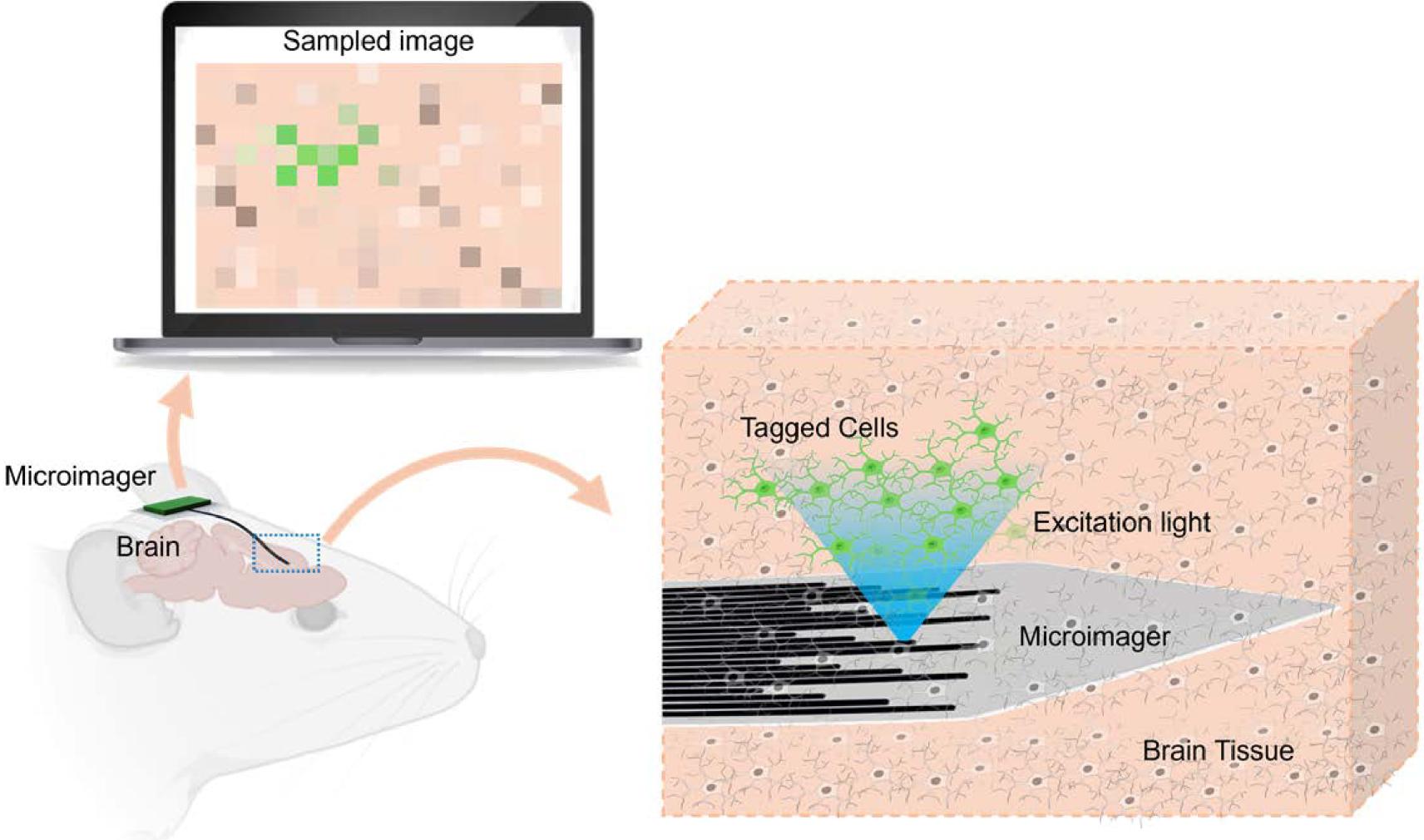 Envisioned schematic design of the microimager