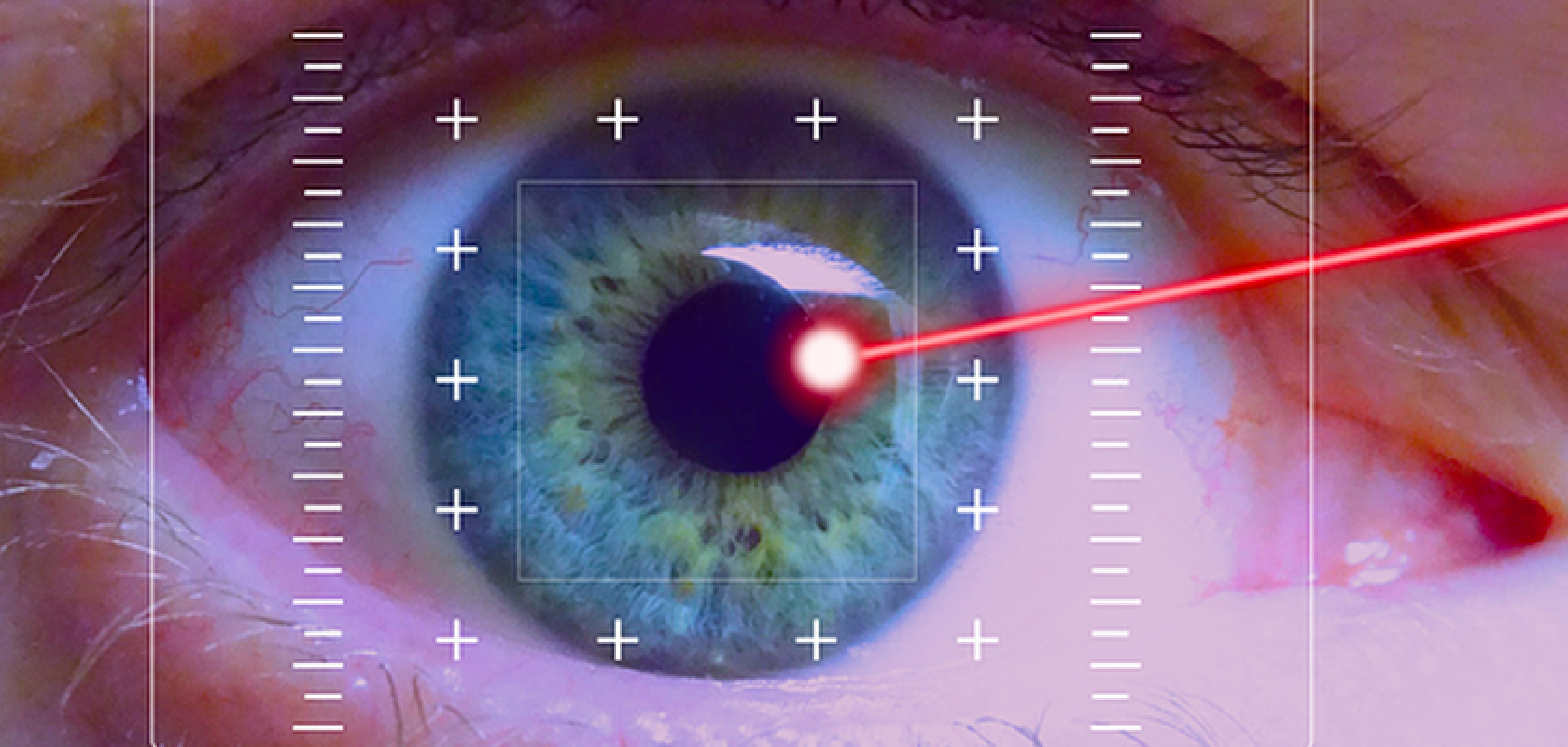 Synchronisation between the scanners and the BitFlow frame grabber supported the cornea imaging technique (Image: The Healthcare Technology Report)