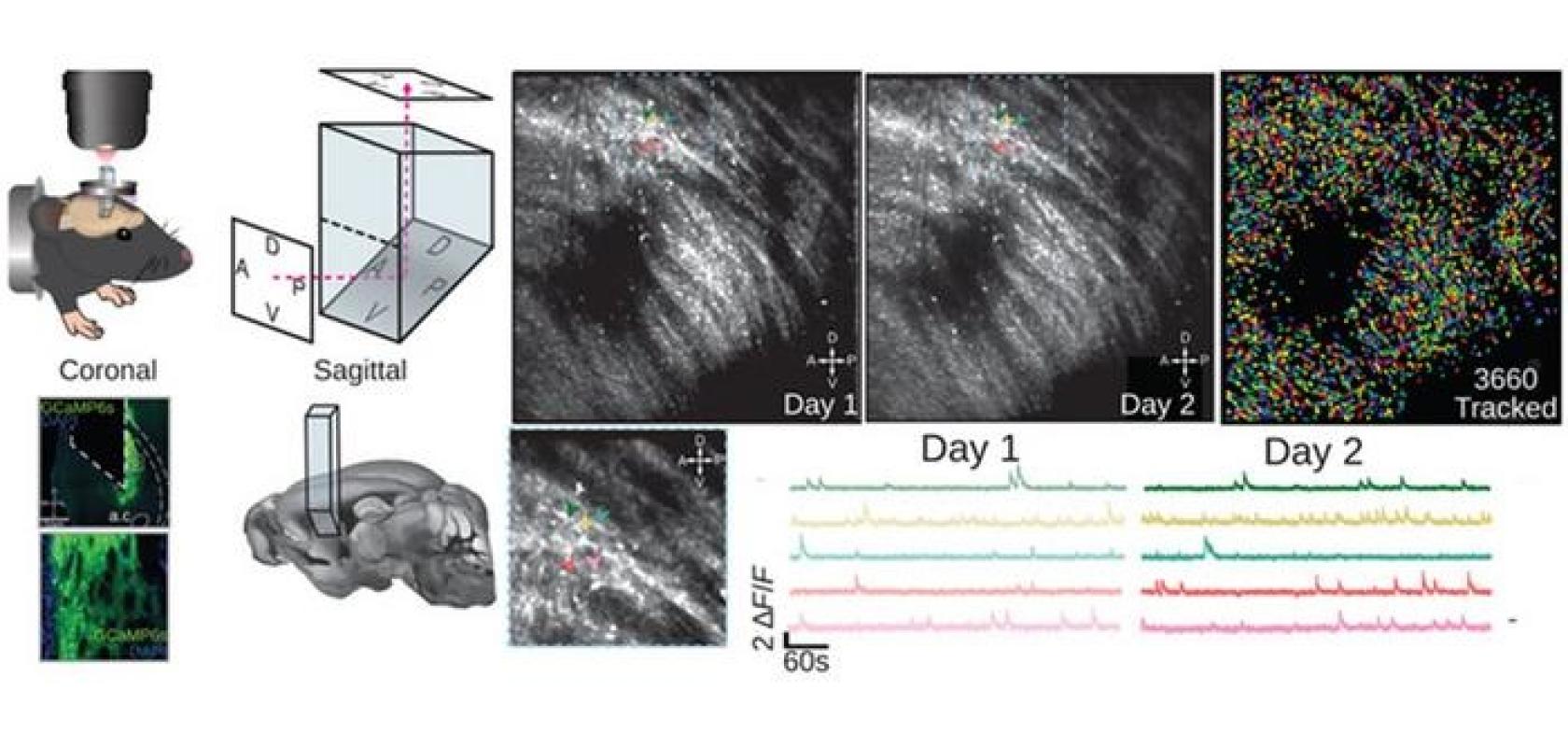 Brain imaging microprism