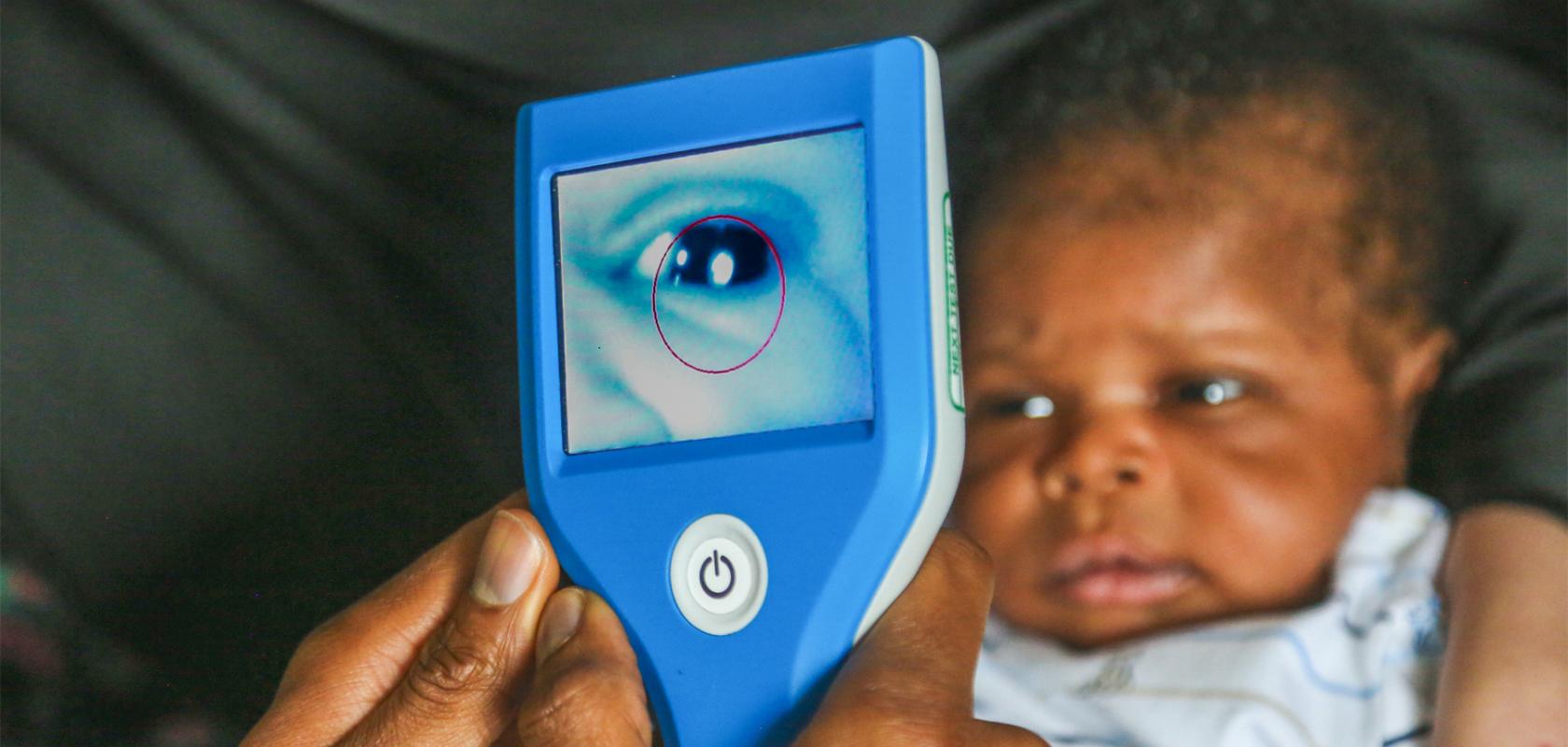 Neocam can be used to detect congenital cataracts in newborns
