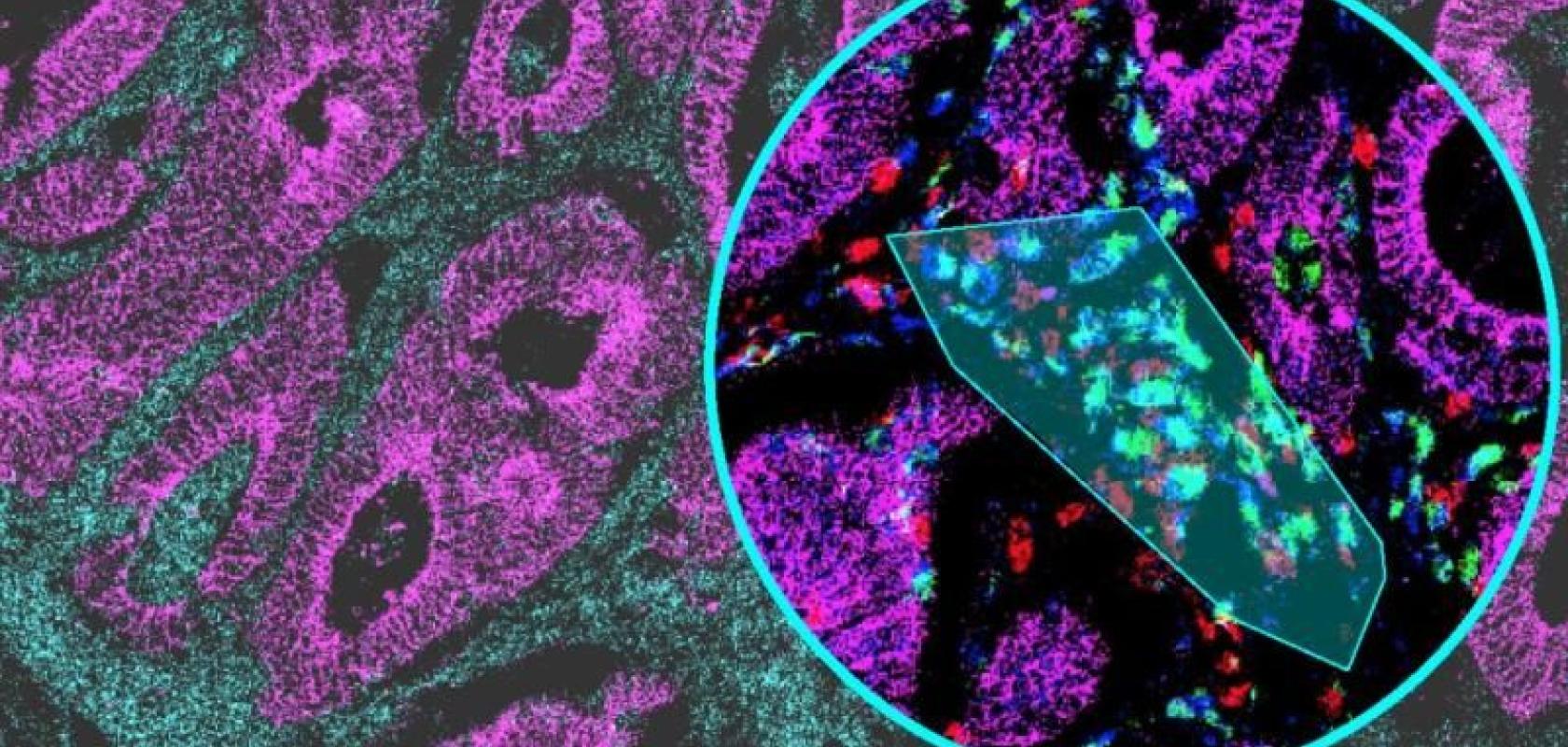 Immunofluorescence multiplex image of human colon tissue