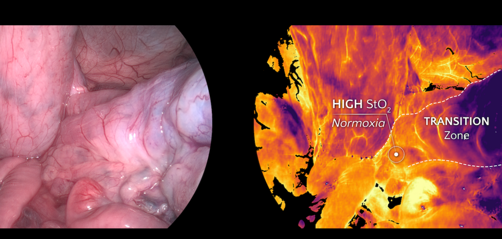 Standard vs hyperspectral image