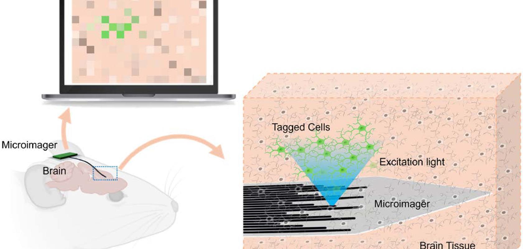 Envisioned schematic design of the microimager