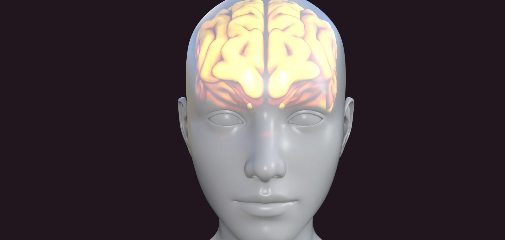 brain injury