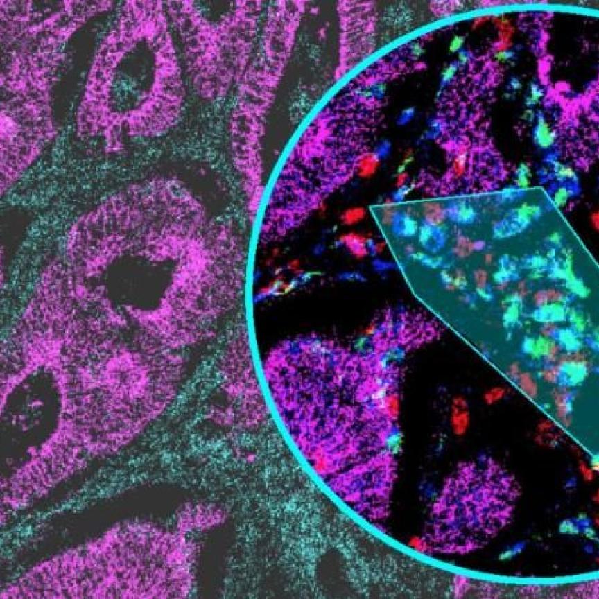 Immunofluorescence multiplex image of human colon tissue