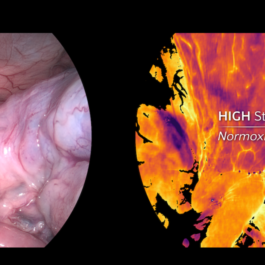 Standard vs hyperspectral image
