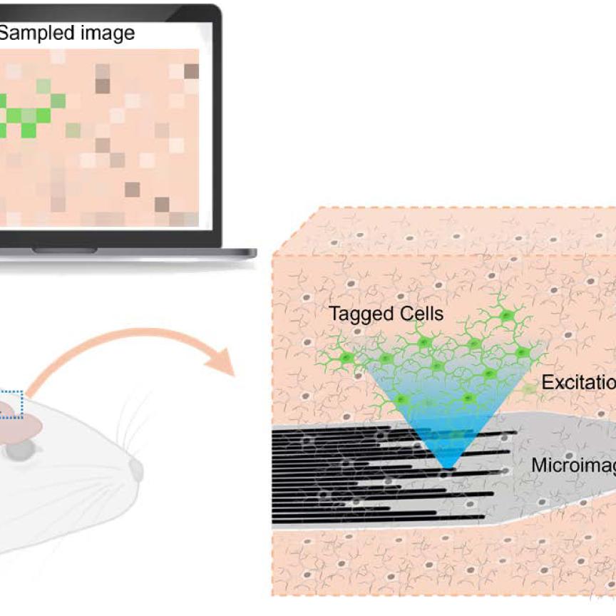 Envisioned schematic design of the microimager